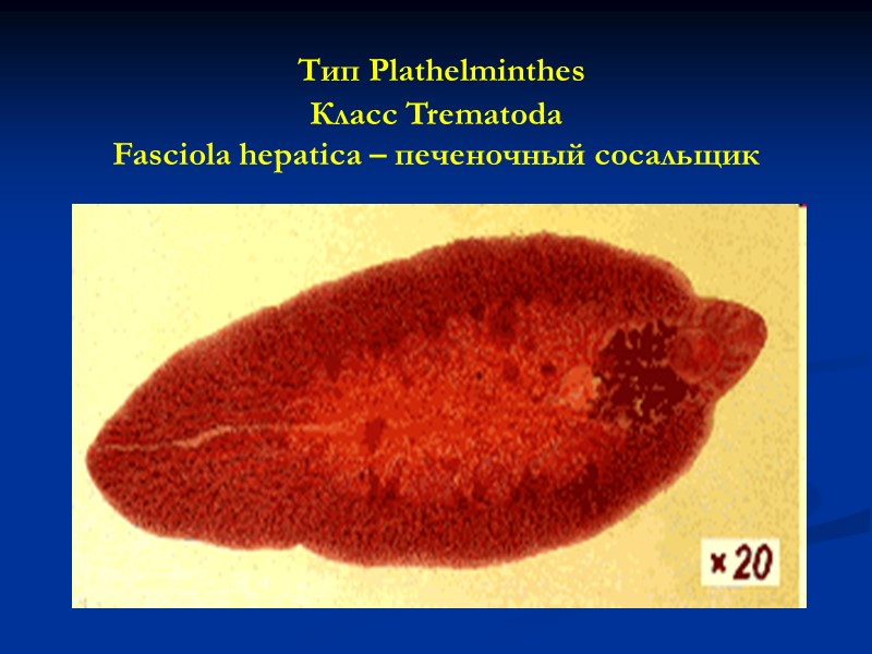 Тип Plathelminthes  Класс Trematoda Fasciola hepatica – печеночный сосальщик